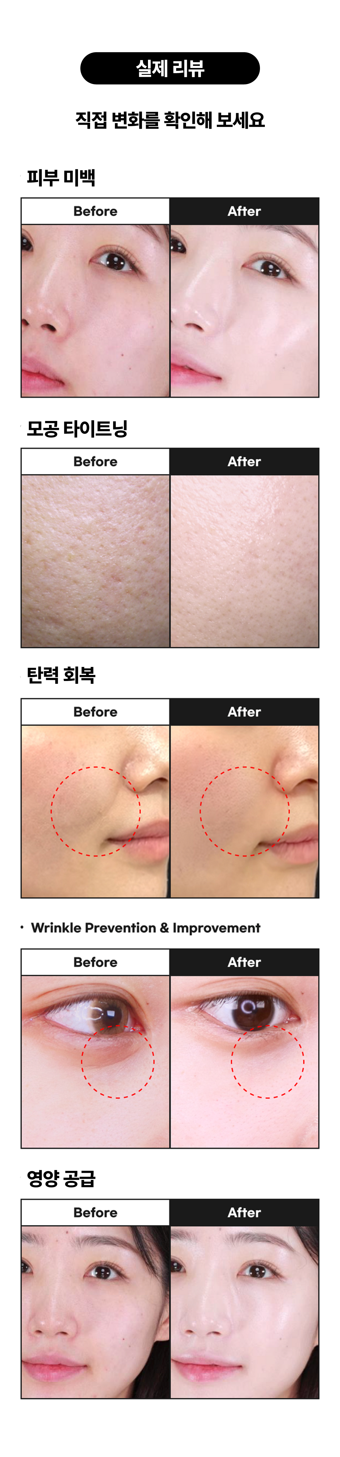 썬데이 투 먼데이 다이아몬드 스피큘  5,000 Shot