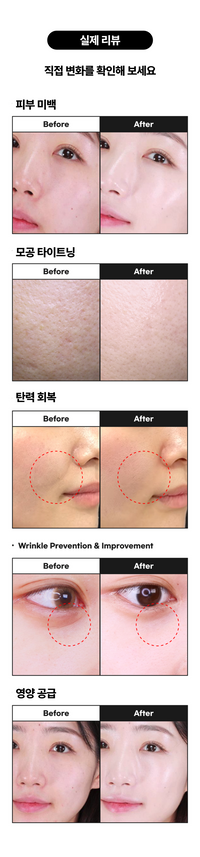 썬데이 투 먼데이 다이아몬드 스피큘  5,000 Shot